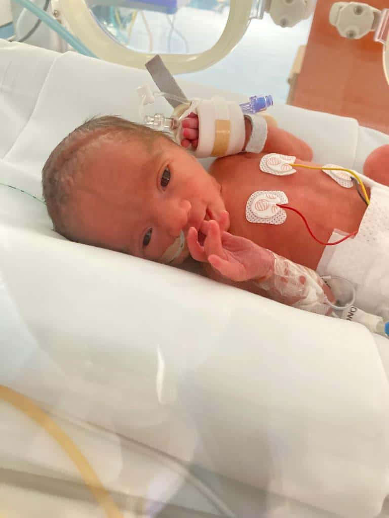 Matteo following his premature birth