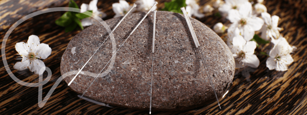 morning sickness remedies: Image shows 4 acupuncture needles sitting on a grey stone